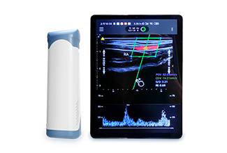 掌上彩色多普勒超聲診斷儀