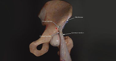 最新解剖結(jié)構(gòu)發(fā)現(xiàn)—股直肌近端肌腱復(fù)合體膜