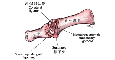 拇指外翻保養(yǎng)小技巧